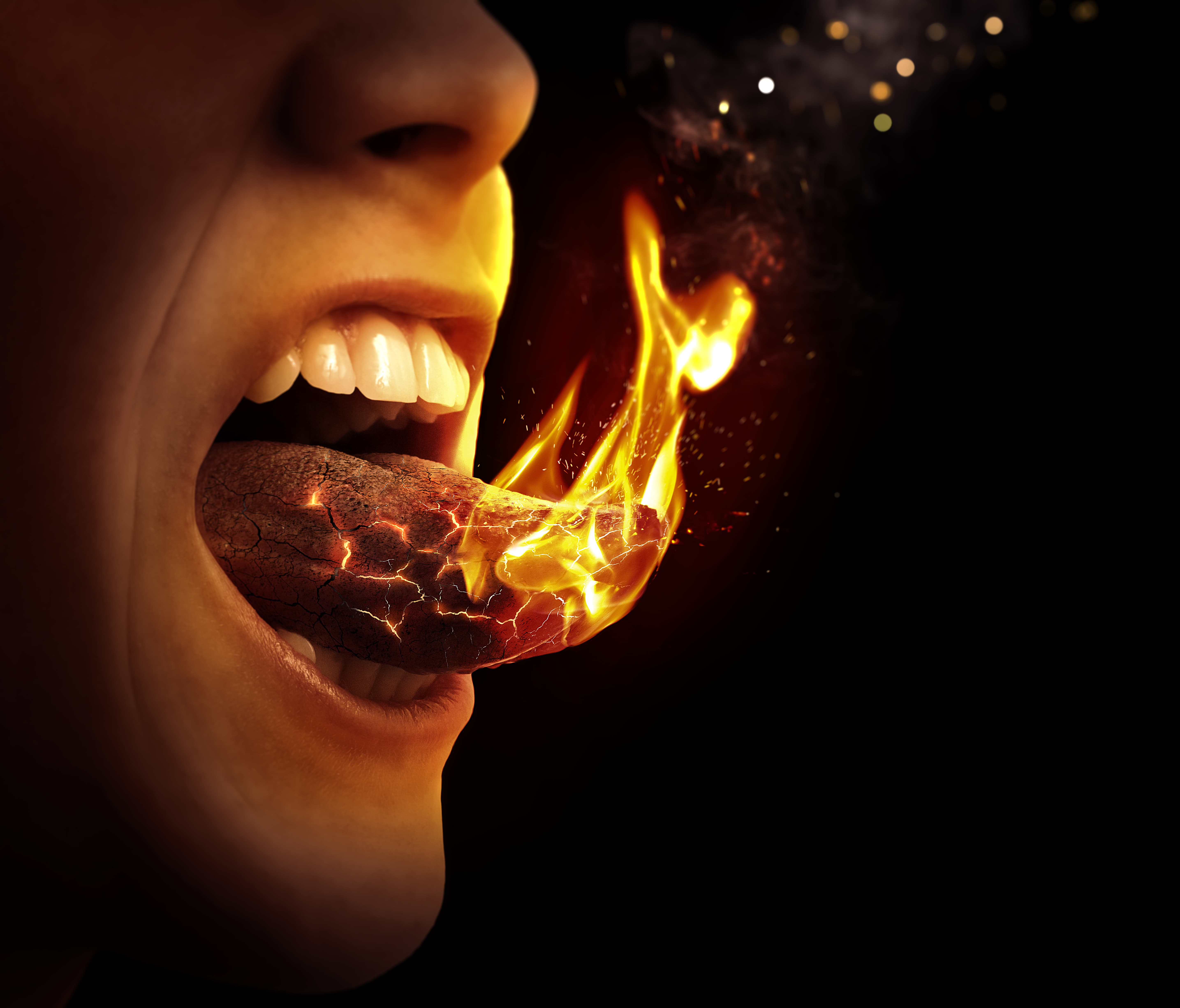 Burning Mouth Syndrome Symptoms Treatment Of Burning Tongue