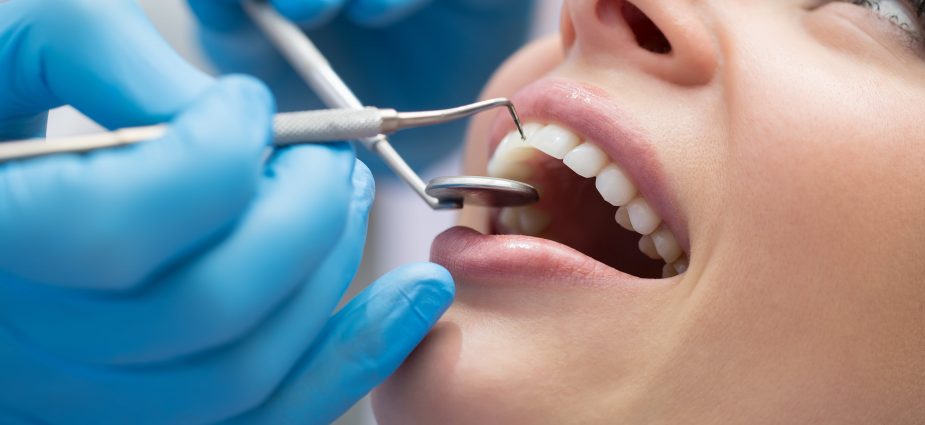 Dental Implants Surrey Hills
