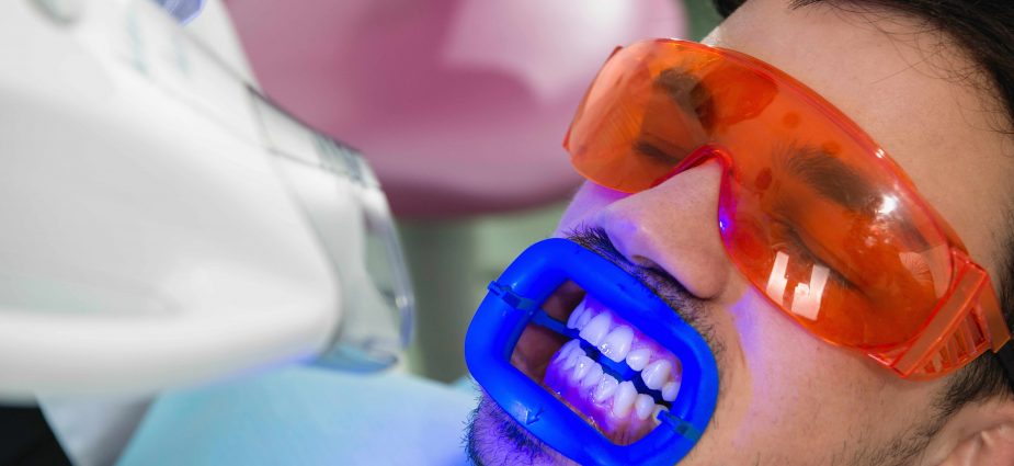 Teeth Whitening - Midway Family Dental Center
