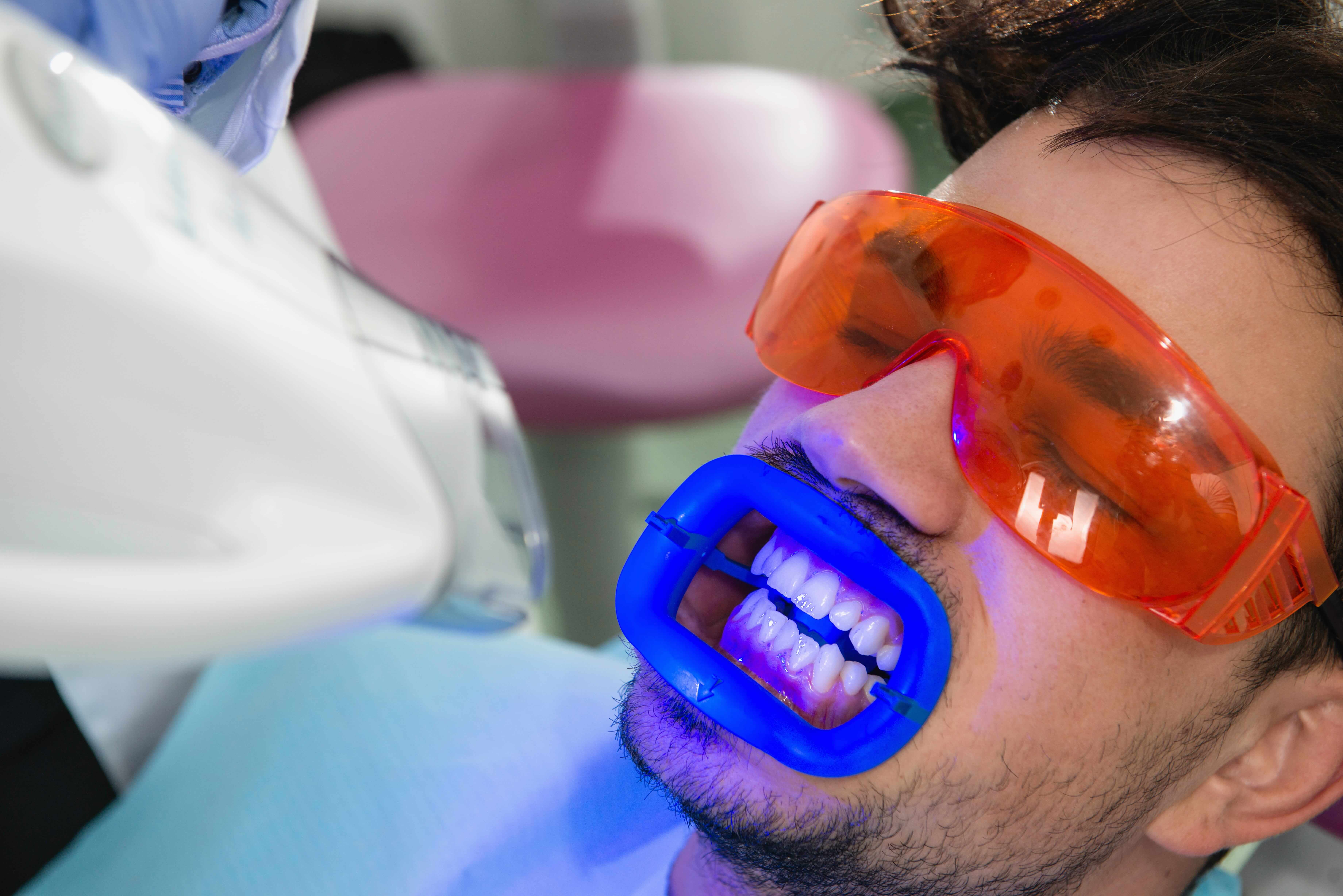 Professional Teeth Whitening | Your Options and What it Costs