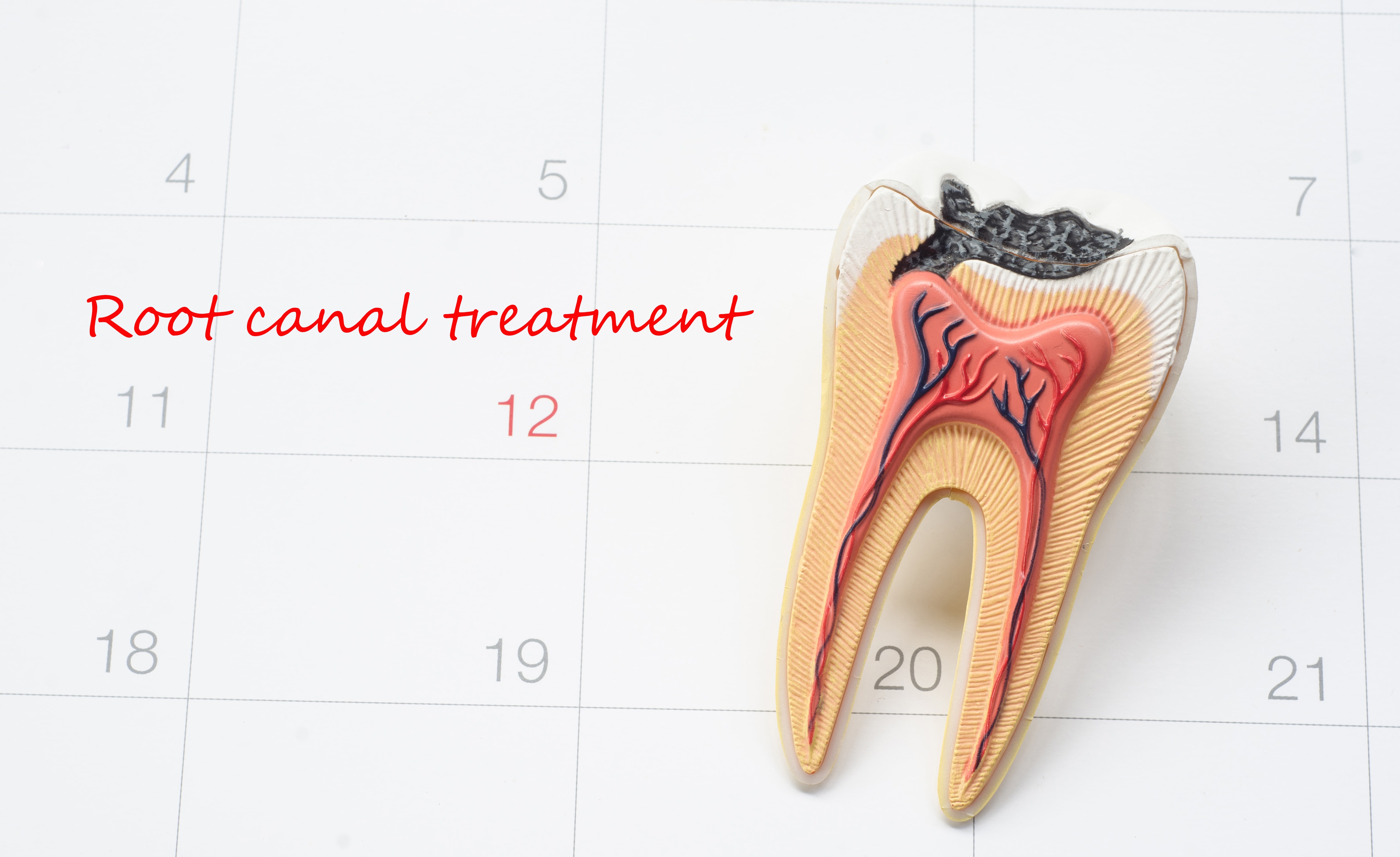 Root Canal Procedure Who Performs It And What Does It Cost 