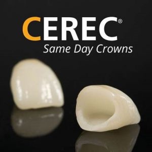 Cerec